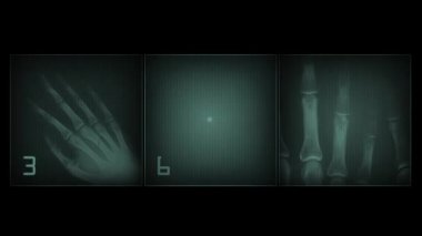 4k animated x-ray simulated body parts