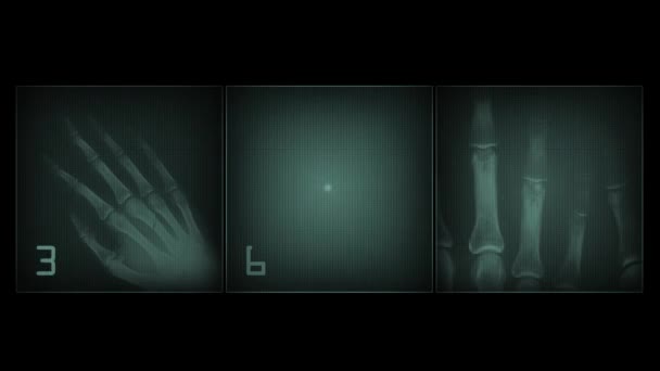 4k animated x-ray simulated body parts — Stock Video