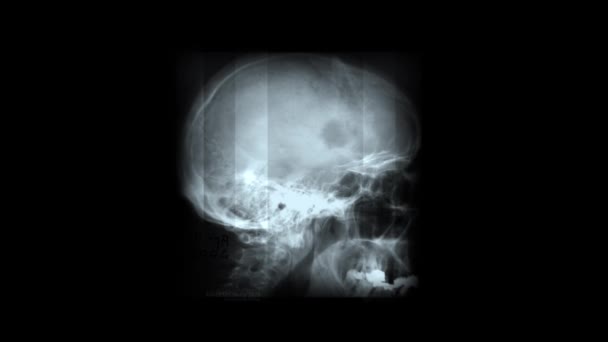Fondo de rayos X animado abstracto 4k — Vídeo de stock