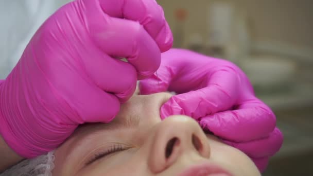 Eyebrow injection closeup — Stock Video