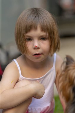 A little girl with a bright red spot on her nose is curiously looking directly at the camera, capturing the moment with her sweet expression