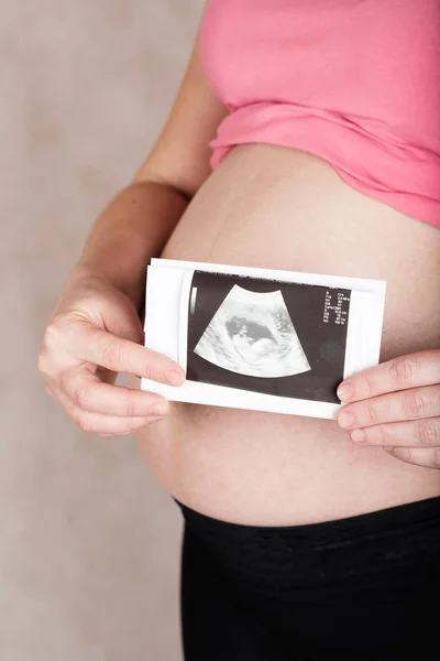 Genç hamile kadın bebeğini görüntüsünü Usg tutar. — Stok fotoğraf