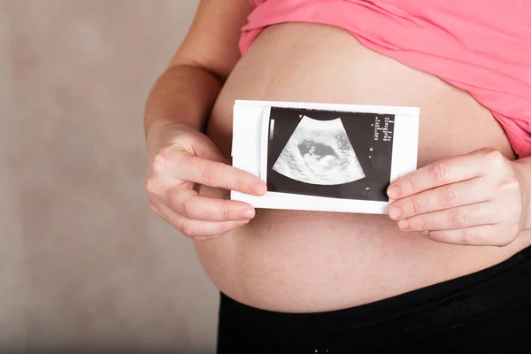 Jovem grávida mantém imagem USG de seu bebê . — Fotografia de Stock