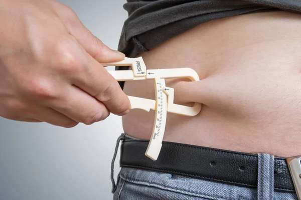 Mann Misst Mit Bremssattel Körperfett Bauch — Stockfoto