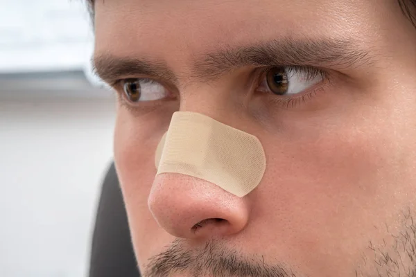 Young Man Gewond Zijn Neus Heeft Gips — Stockfoto