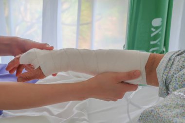 Kırık kol kıdemli hasta için elastik bandaj koymak hemşire