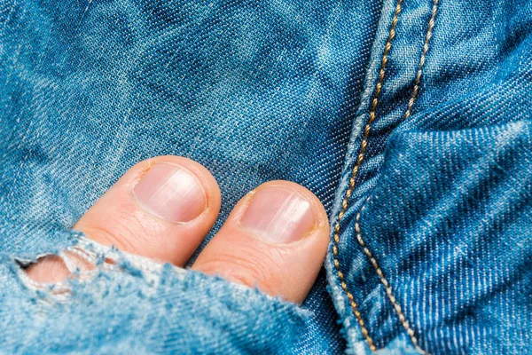 Dois Dedos Humanos Sobressaem Buraco Jeans — Fotografia de Stock