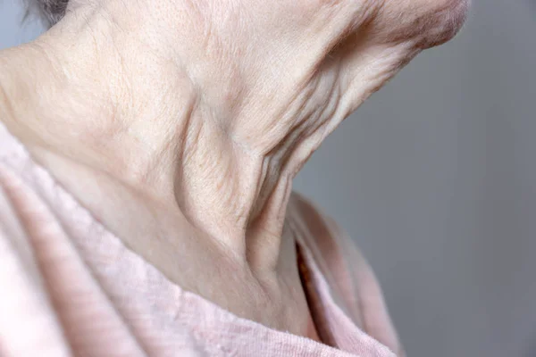 A flabby wrinkled excess skin on the neck of a senior woman close up — Stock Photo, Image