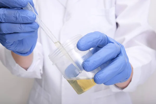 Un médecin, technicien de laboratoire en gants bleus tenant un échantillon d'urine dans un récipient en plastique, analyse d'urine et remplissage de la pipette avec de l'urine pour les tests, concept de contrôle médical — Photo