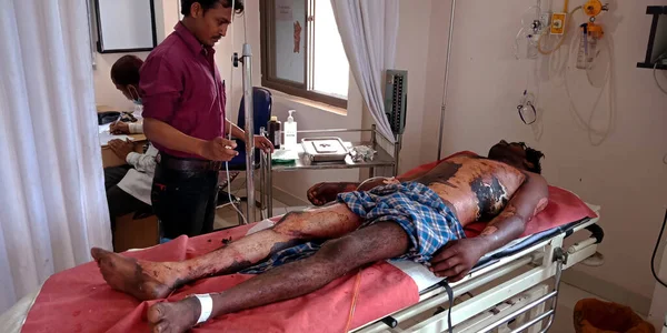 DİSTRİK KATNI, Hindistan - 28 Eylül 2019: Hintli bir erkek doktor şehir devlet hastanesinde yanan hastayı kontrol ediyor.
