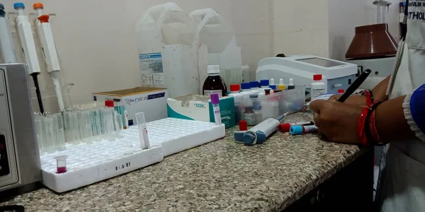 District Katni India Wrzesień 2019 Narzędzia Laboratoryjne Patologiczne Trzymane Oddziale — Zdjęcie stockowe