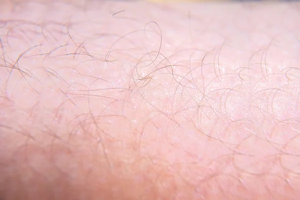 Rambut Tertutup Pada Kulit Manusia Tekstur Latar Belakang — Stok Foto