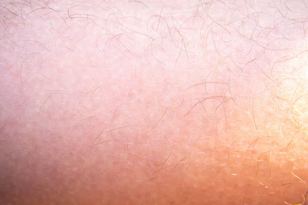 Κοντινές Τρίχες Στο Ανθρώπινο Δέρμα Υφή Φόντου — Φωτογραφία Αρχείου