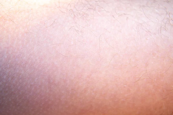 Closeup Hair Human Skin Background Texture — Stock Photo, Image