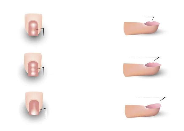 L'immagine delle unghie delle dita. tutorial per imparare la manicure. illustrazione vettoriale isolata su sfondo bianco. scivolo per servizio unghie. salone di bellezza . — Vettoriale Stock