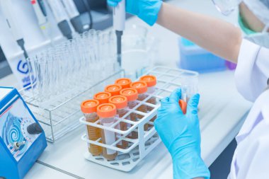 Bilim insanları deneyden önce kimyasalları plastik tüplere enjekte ettiler. Bilim adamı, deneyden önce sallama makinesiyle kimyasalları karıştırdı. Örnekleri test tüplerine karıştırıp test için numune hazırladı.