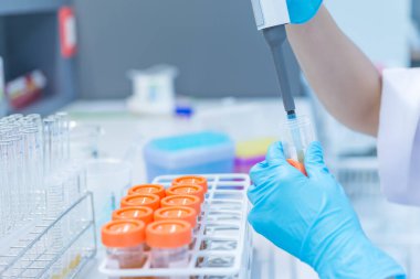 Bilim insanları deneyden önce kimyasalları plastik tüplere enjekte ettiler. Bilim adamı, deneyden önce sallama makinesiyle kimyasalları karıştırdı. Örnekleri test tüplerine karıştırıp test için numune hazırladı.