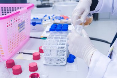 Bilim adamı deneyden önce kimyasalları sallama makinesiyle karıştırdı. Laboratuvarda çalışan Tayland 'lı bilim adamı test tüplerine numuneler karıştırdı.