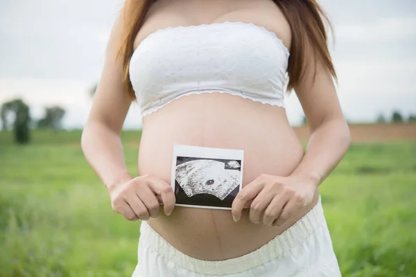 Jong Mooi Zwanger Vrouw Tonen Ultrasound Beeld Haar Zoon Heldere — Stockfoto