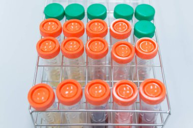 Raftaki plastik tüp, bilim adamı deneyi için örnek hazırla.