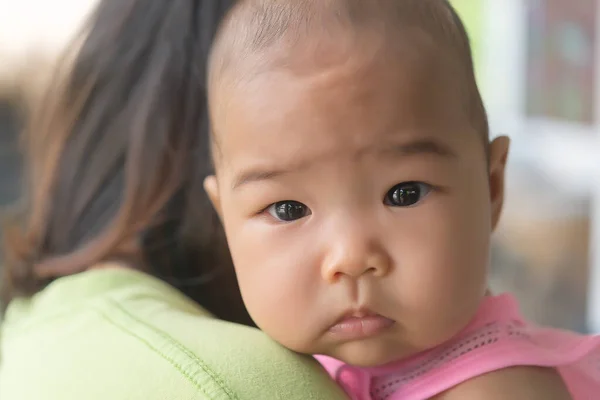 Close Asian Little Girl Baby Has Bald Thailand People Recently — Stock Photo, Image