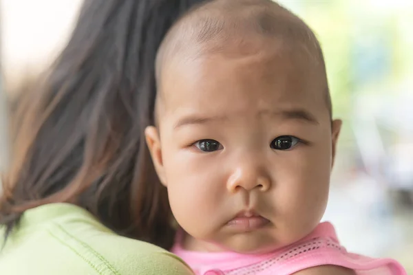 Close Asian Little Girl Baby Has Bald Thailand People Recently — Stock Photo, Image