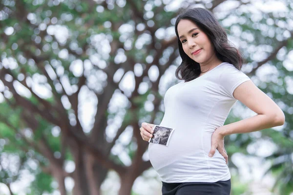 Porträt Einer Asiatischen Schönen Schwangeren Park Thailändische Menschen Glückliche Frau — Stockfoto