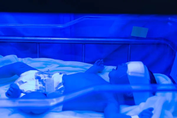 Newborn Treated Phototherapy Blue Neon Light Asian Baby Body Yellow — стоковое фото