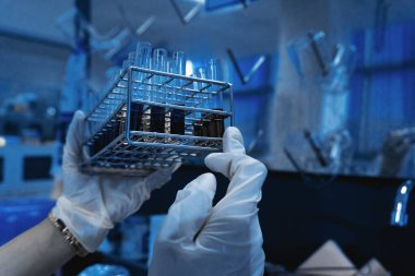 Bilim adamı deneyden önce kimyasalları sallama makinesiyle karıştırdı. Laboratuvarda çalışan Tayland 'lı bilim adamı test tüplerine numuneler karıştırdı.