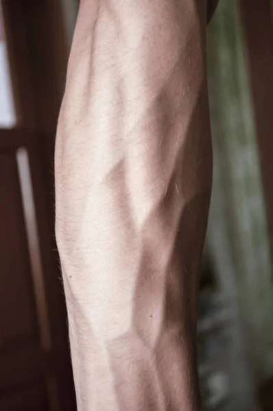 18 yaşında bir adamın kolları dışa dönük damarları var.