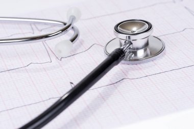 Kağıt elektrokardiyogramında stetoskop veya fonnkop. Tıbbi muayene