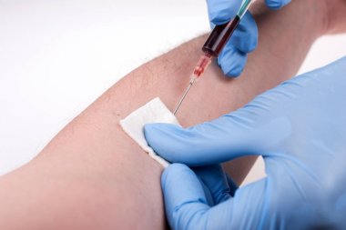 Şırınga kullanan mavi lastik eldivenli hemşire, hastaya kol hizasında ki kanı emer. Testler kan Sağlık checkup