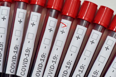 Gri arkaplan üzerinde kan testi örneği içeren tüpler arasında pozitif COVID19 testini kapat. Yeni virüs enfeksiyonu testi, Covid 19. Coronavirus konsepti