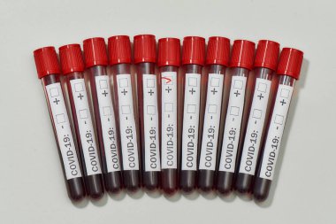 Gri arkaplan üzerinde kan testi örneği içeren tüpler arasındaki pozitif COVID19 testinin üst görüntüsü. Yeni virüs enfeksiyonu testi, Covid 19. Coronavirus konsepti.
