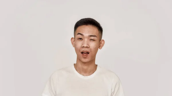 Вінк. Портрет молодого азіатського чоловіка з чистим оголеним обличчям виглядає веселим, підморгуючи на камері ізольовано на білому тлі. Краса, скінарій, концепція здоров'я — стокове фото