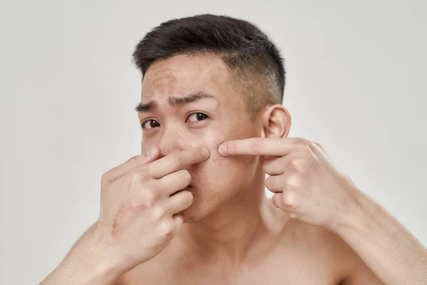 Primer plano retrato de sin camisa joven asiático hombre con problemática piel chequeando su piel, apretando grano aislado sobre blanco fondo — Foto de Stock