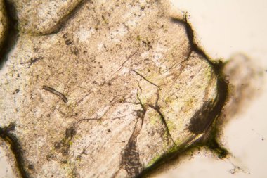 Mikroskobik görünümü ve çürük Lale kök detaylarını 