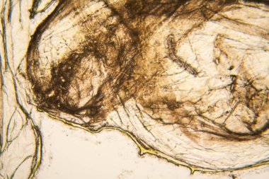 Mikroskobik görünümü ve çürük Lale kök detaylarını 