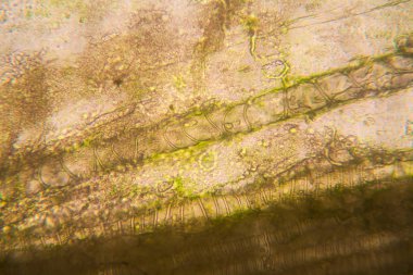 Mikroskobik görünümü ve çürük Lale kök detaylarını 