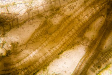 Mikroskobik görünümü ve çürük Lale kök detaylarını 