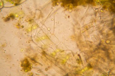 Taze su birikintisi su planktonları ve yosun, mikroskop. Ölü copepod Ayrıntılar 