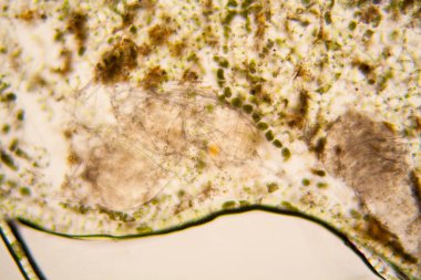 Taze su birikintisi su planktonları ve yosun, mikroskop. Ölü copepod