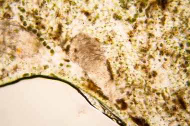 Taze su birikintisi su planktonları ve yosun, mikroskop. Ölü copepod 