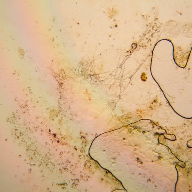 Taze su birikintisi su planktonları ve yosun, mikroskop. Ölü copepod 