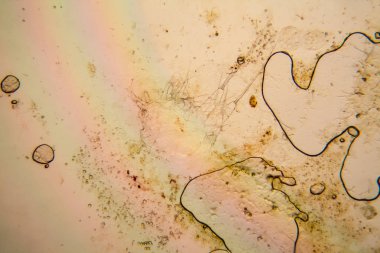 Taze su birikintisi su planktonları ve yosun, mikroskop. Ölü copepod Ayrıntılar 