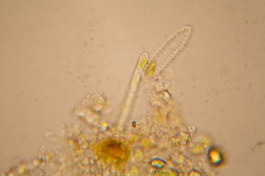 Taze su birikintisi su planktonları ve yosun, mikroskop. Diyatomlarla