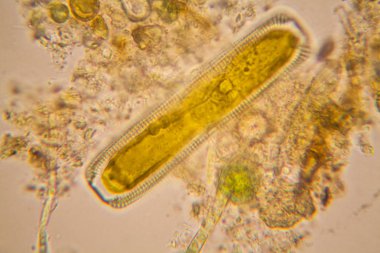 Fresh pond water plankton and algae at the microscope. Diatoms clipart