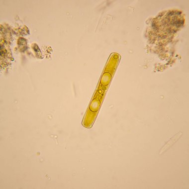 Taze su birikintisi su planktonları ve yosun, mikroskop. Diyatomlarla