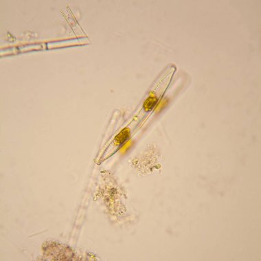 Taze su birikintisi su planktonları ve yosun, mikroskop. Diyatomlarla