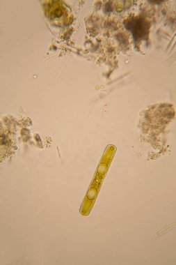 Taze su birikintisi su planktonları ve yosun, mikroskop. Diyatomlarla